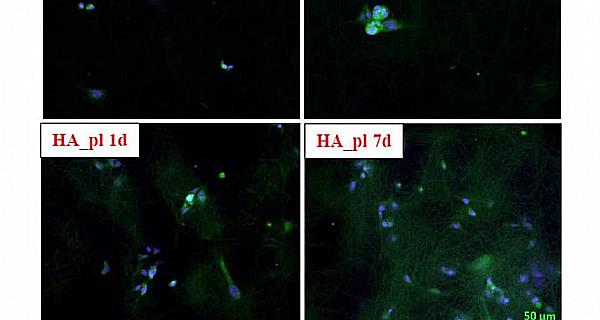 Snímky z fluorescenční mikroskopie buněk na testovaných materiálech